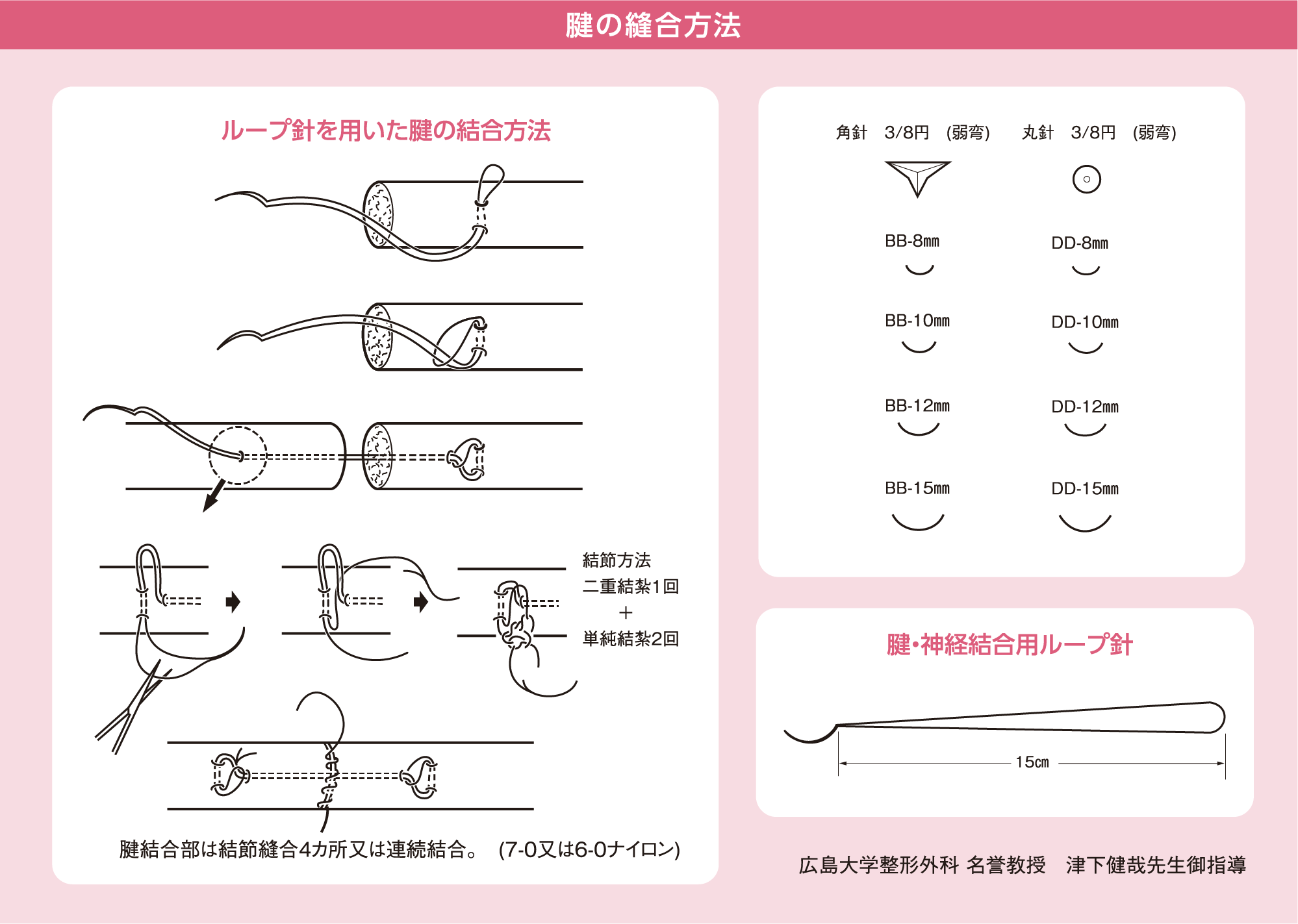 腱の縫合方法